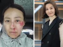 미스코리아 출신 배우 전혜진, 뜻밖의 사고로 팬들 놀라움 기사의 썸네일